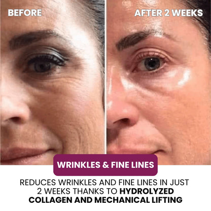 Hydrolyzed Collagen Age Defying Mask