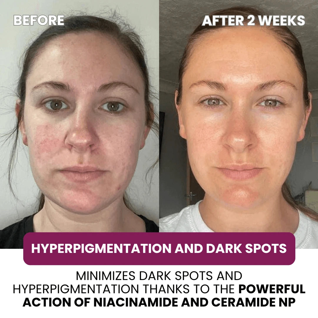 Hydrolyzed Collagen Age Defying Mask