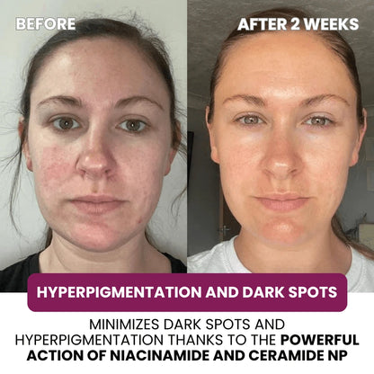 Hydrolyzed Collagen Age Defying Mask