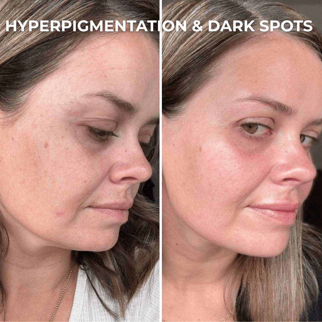 Masque Hydrogel au PDRN et aux Peptides de Collagène