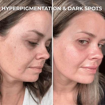Masque Hydrogel au PDRN et aux Peptides de Collagène