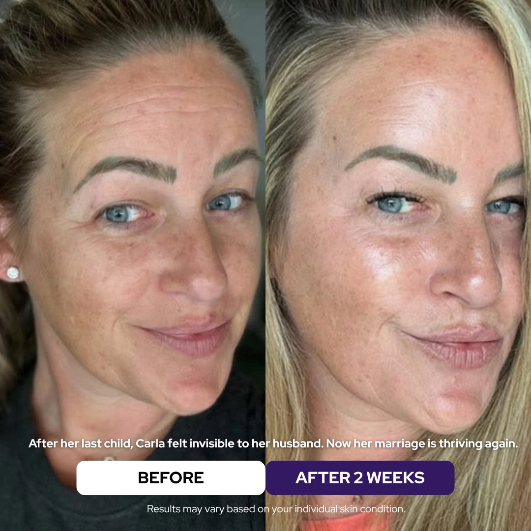 Maschera Rigenerante al Collagene Idrolizzato & Niacinamide