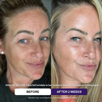Maschera Rigenerante al Collagene Idrolizzato & Niacinamide