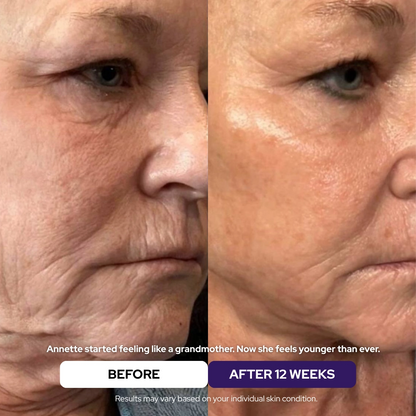 Maschera Rigenerante al Collagene Idrolizzato & Niacinamide