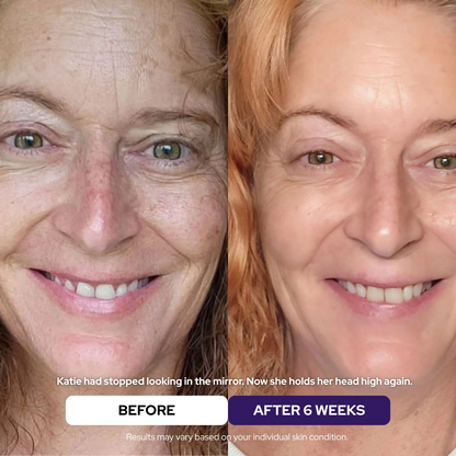Maschera Rigenerante al Collagene Idrolizzato & Niacinamide