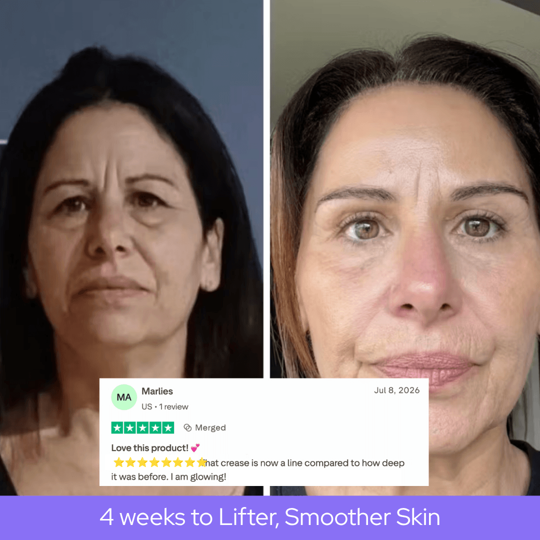 1. Softens the Look of Forehead and Frown Lines
