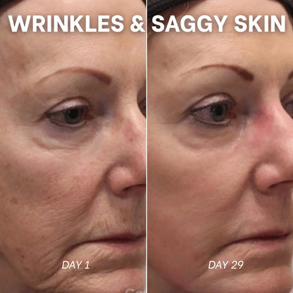 Masque Hydrogel au PDRN et aux Peptides de Collagène