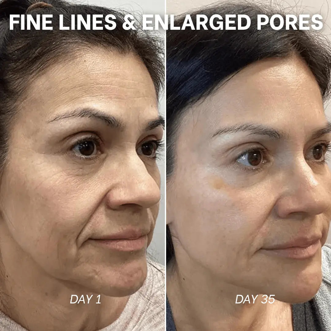 Masque Hydrogel au PDRN et aux Peptides de Collagène