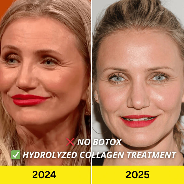 8. BONUS: It’s proven to be an effective alternative to Botox