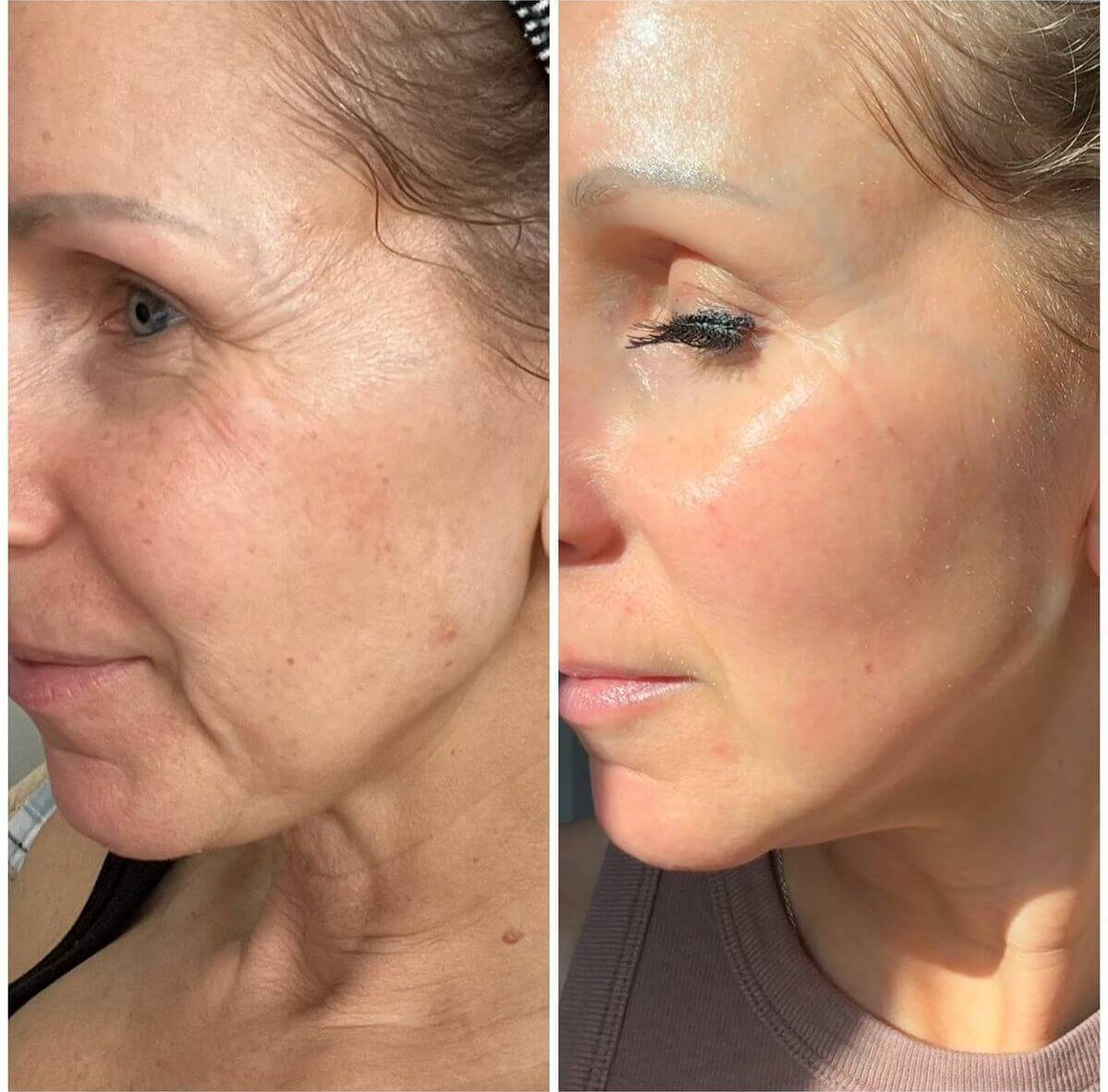 6. Fades the Look of Dark Spots and Dullness
