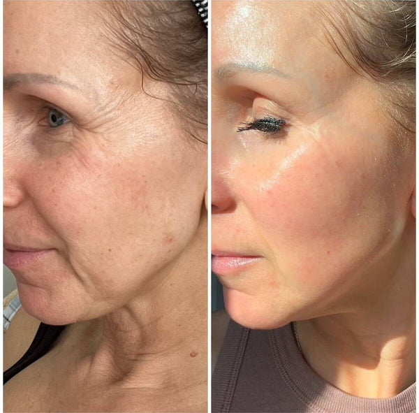 6. Fades the Look of Dark Spots and Dullness
